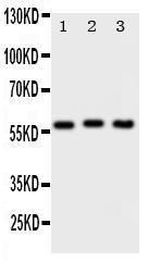 Anti-PKM2 Rabbit Polyclonal Antibody