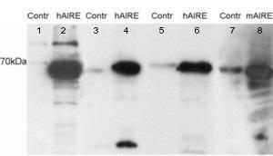 Anti-AIRE Antibody (A83252) staining (0.05 µg/ml) of HEK293 cell lysates. Untransfected (Lane 5 and 7) and transfected with Human AIRE (lane 6) or Mouse AIRE (lane 7)