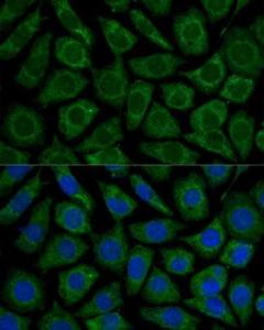 Immunofluorescence analysis of L929 cells using Anti-NDUFS2 Antibody (A92953) at a dilution of 1:100. DAPI was used to stain the cell nuclei (blue)