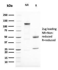 Anti-Vimentin antibody