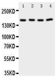 Anti-Phospholipase A2 Rabbit Polyclonal Antibody