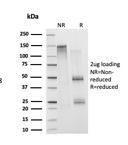 SDS-PAGE analysis of Anti-Histone H1 Antibody [1415-1] under non-reduced and reduced conditions; showing intact IgG and intact heavy and light chains, respectively. SDS-PAGE analysis confirms the integrity and purity of the Antibody