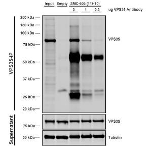 Immunoprecipitation analysis of mouse embryonic fibroblast using Anti-VPS35 Antibody [11H10] (A305037). Three amounts of A305037 (3, 1 and 0.3 ug) were non-covalently coupled to 10uL of A/G sepharose beads for 1 hour at 4 °C and next incubated with 250ug of MEF lysate for 2 hours at 4 °C