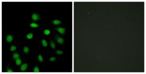 Immunofluorescence analysis of HepG2 cells using Anti-SCAND1 Antibody. The right hand panel represents a negative control, where the antibody was pre-incubated with the immunising peptide