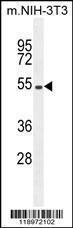 Anti-EIF2B4 Rabbit Polyclonal Antibody (PE (Phycoerythrin))