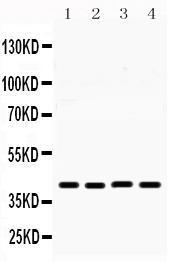 Anti-MICB Antibody