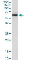 Anti-AGER Rabbit Polyclonal Antibody