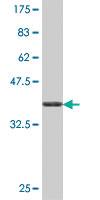 Anti-PRPS1 Mouse Polyclonal Antibody