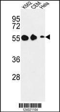 Anti-GALR1 Rabbit Polyclonal Antibody (FITC (Fluorescein Isothiocyanate))