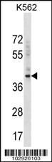 Anti-BMI Rabbit Polyclonal Antibody