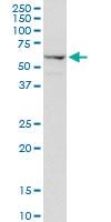 Anti-AGER Rabbit Polyclonal Antibody