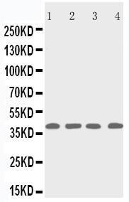 Anti-p53R2 Rabbit Polyclonal Antibody