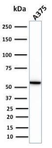 Anti-Vimentin antibody