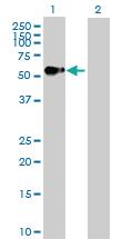 Anti-AGER Rabbit Polyclonal Antibody