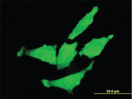 Anti-ERBB2 Mouse Monoclonal Antibody [clone: 3B1]