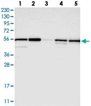 Anti-PMPCA Rabbit Polyclonal Antibody