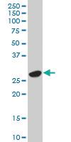 Anti-UCHL1 Mouse Polyclonal Antibody