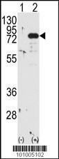 Anti-PKC beta1/2 Rabbit Polyclonal Antibody (APC (Allophycocyanin))