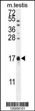 Anti-CAMK2N1 Rabbit Polyclonal Antibody (AP (Alkaline Phosphatase))