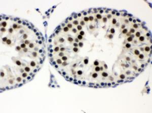 Anti-MNAT1 Antibody