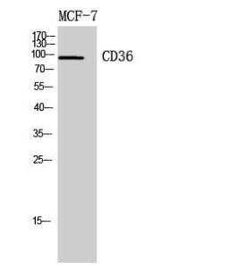 Western blot analysis of MCF7, 4T1 cells using Anti-CD36 Antibody