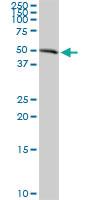 Anti-AGER Rabbit Polyclonal Antibody