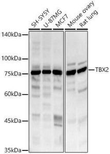 Antibody anti-TBX2 100 µl