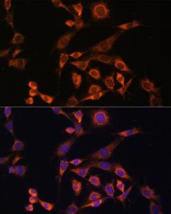 Anti-MEK2 Rabbit Polyclonal Antibody