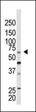 Anti-PC2 (CBX4) Rabbit Polyclonal Antibody