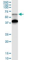 Anti-AGER Rabbit Polyclonal Antibody