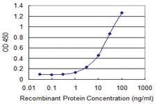 Anti-ERBB2 Mouse Monoclonal Antibody [clone: 3B1]