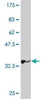 Anti-ATP7B Mouse Monoclonal Antibody [clone: 3E10]