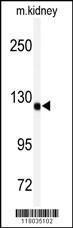 Anti-ADAMTS19 Rabbit Polyclonal Antibody (AP (Alkaline Phosphatase))