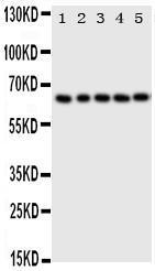 Anti-p63 Rabbit Polyclonal Antibody