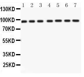 Anti-p95 NBS1 Antibody