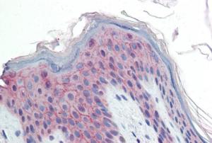 Anti-PPPDE1 Antibody (A84870) (10 µg/ml) staining of paraffin embedded Human Skin Steamed antigen retrieval with citrate buffer pH 6, AP-staining