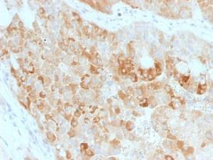 Anti-ROR2 Mouse Monoclonal Antibody [clone: ROR2/1911]