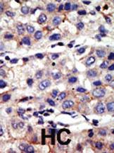 Anti-PC2 (CBX4) Rabbit Polyclonal Antibody