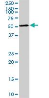 Anti-AGER Rabbit Polyclonal Antibody