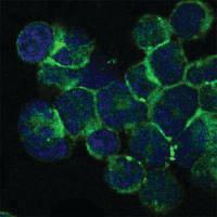 Anti-ITK Mouse Monoclonal Antibody [clone: 5G6]