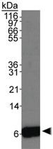 Anti-S100 A6 Rabbit Polyclonal Antibody