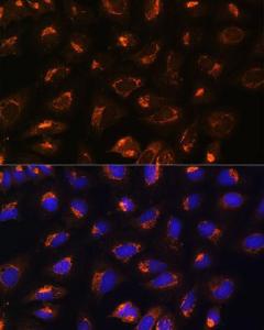 Anti-MEK2 Rabbit Polyclonal Antibody