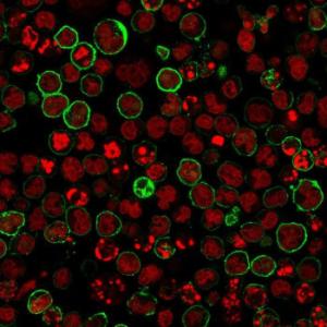 Anti-CD20 Mouse Monoclonal Antibody [clone: L26 + IGEL/773]