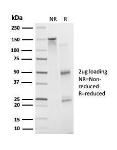 SDS-PAGE analysis of Anti-ATF2 Antibody [PCRP-ATF2-1B4] under non-reduced and reduced conditions; showing intact IgG and intact heavy and light chains, respectively. SDS-PAGE analysis confirms the integrity and purity of the antibody