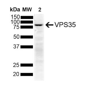 Western blot analysis of human SH-SY5Y showing detection of VPS35 protein using Anti-VPS35 Antibody [11H10] (A305037) at 1:1,000 for 2 hours at room temperature with shaking