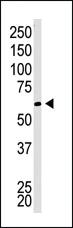 Anti-CBX4 Rabbit Polyclonal Antibody