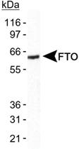 Anti-FTO Rabbit Polyclonal Antibody