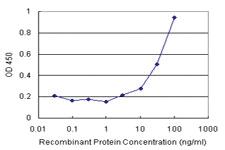 Anti-MVD Antibody Pair