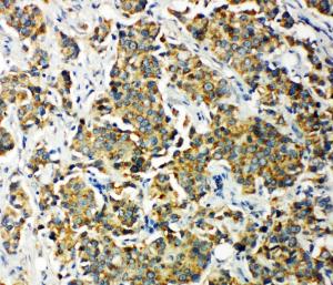 Anti-PDK2 Rabbit Polyclonal Antibody