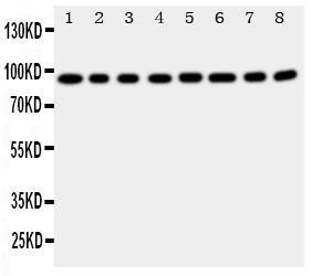 Anti-Factor VIII Rabbit Polyclonal Antibody